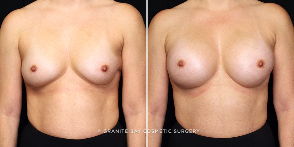 Case # 18 after photo