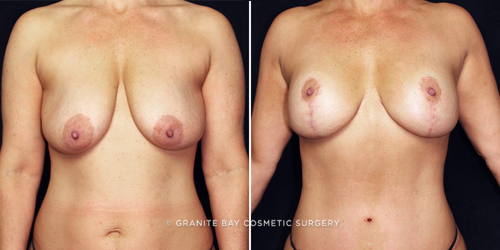 Case # 8 after photo