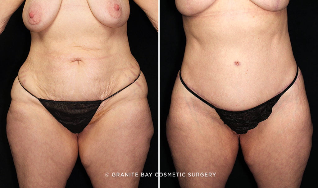 Case # 16 after photo