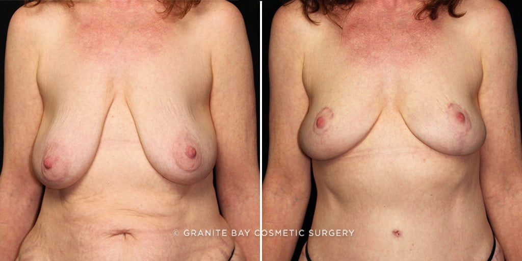 Case # 5 after photo