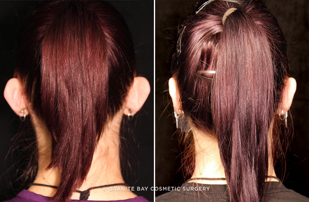 Case # 2 after photo