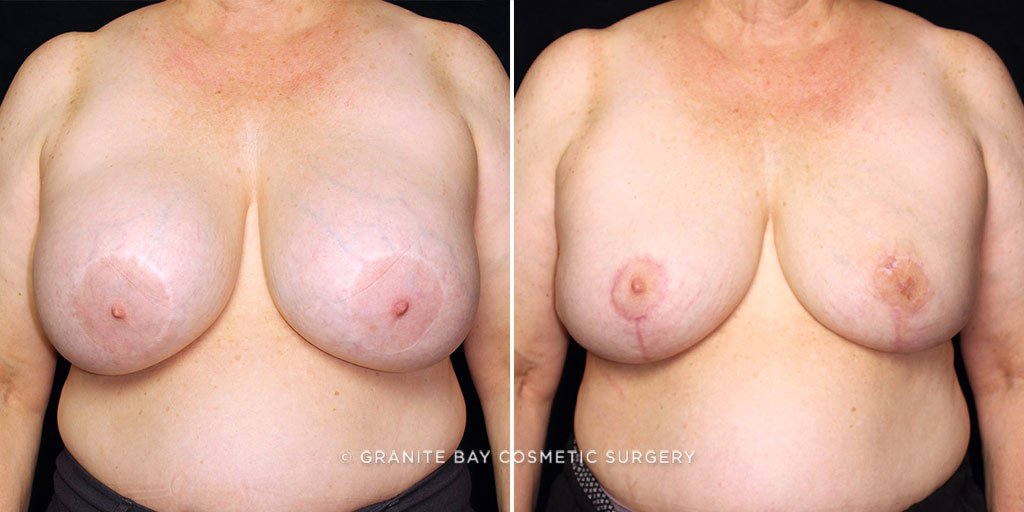 Case # 9 after photo