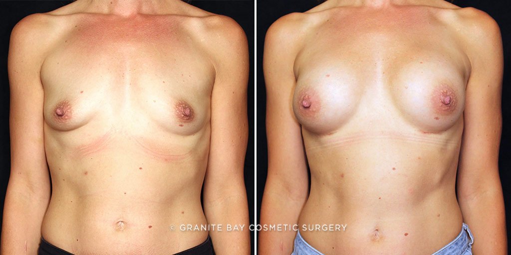 Case # 21 after photo