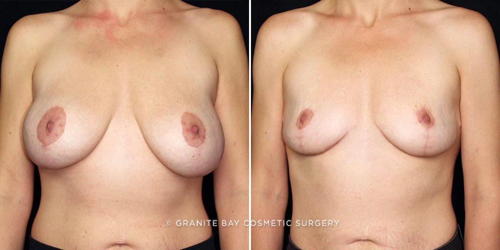 Case # 10 after photo