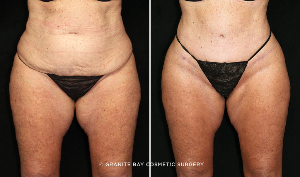 Case # 5 after photo