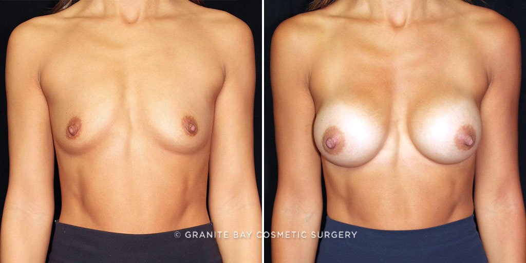 Case # 22 after photo