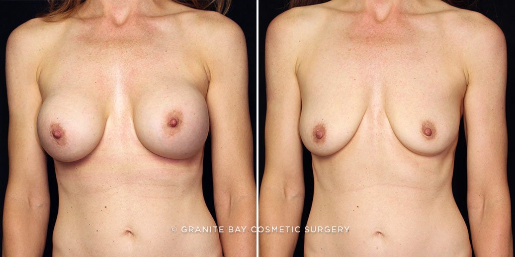 Case # 13 after photo