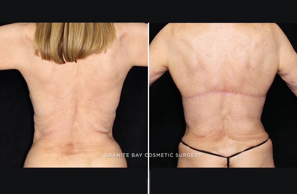 Case # 16 after photo