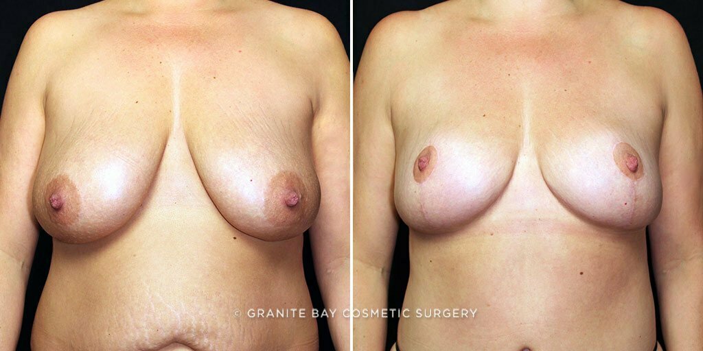 Case # 6 after photo