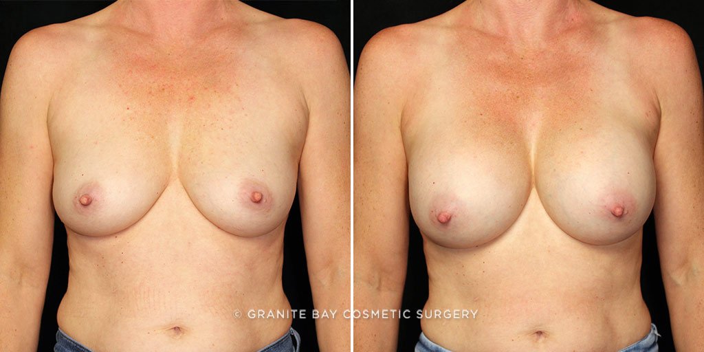 Case # 23 after photo