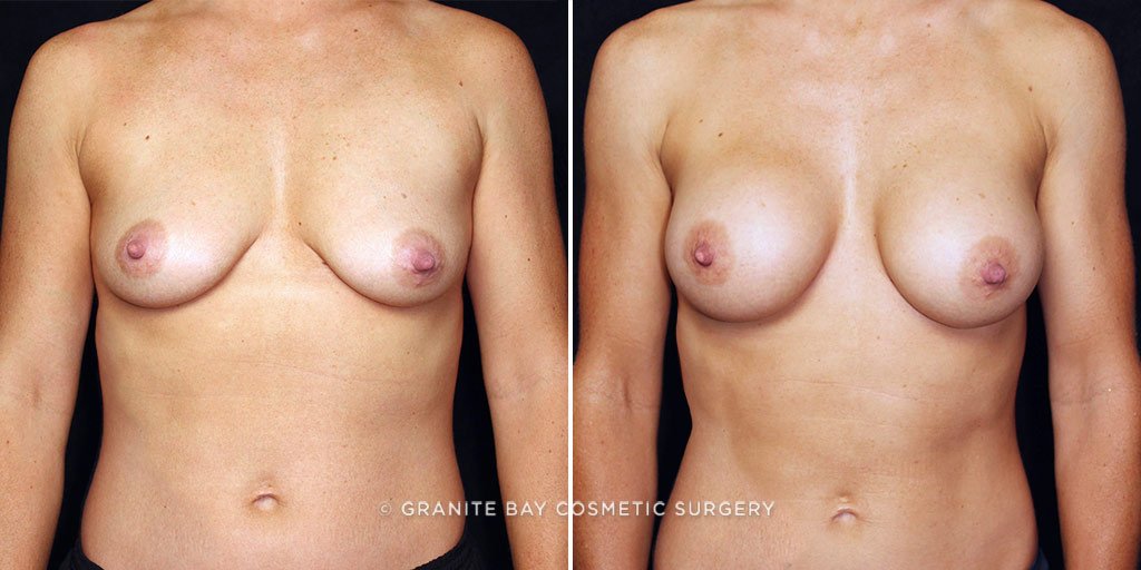 Case # 24 after photo