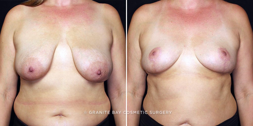 Case # 7 after photo