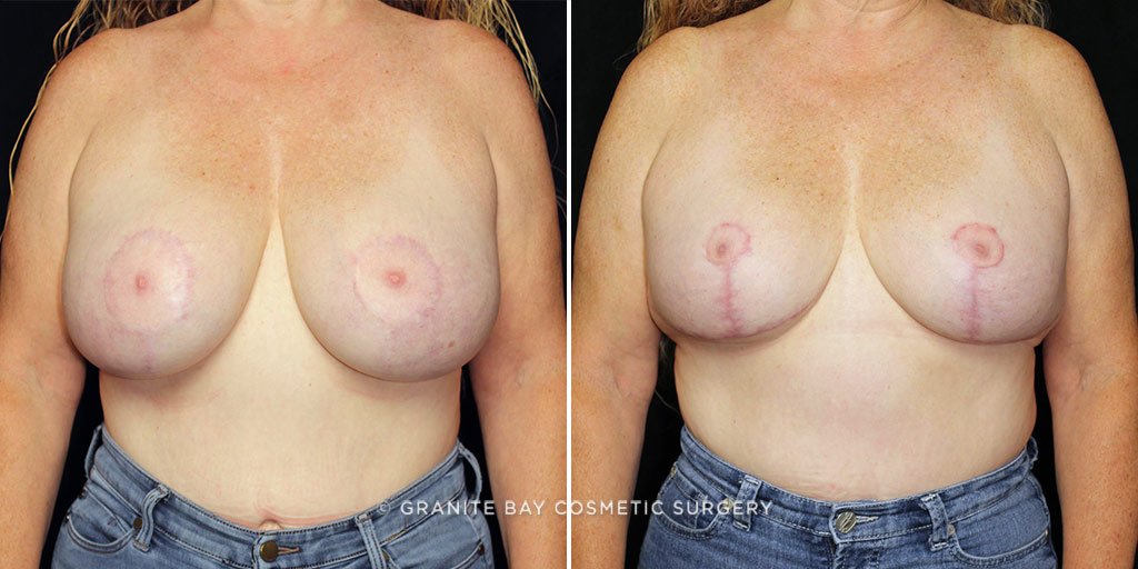 Case # 7 after photo