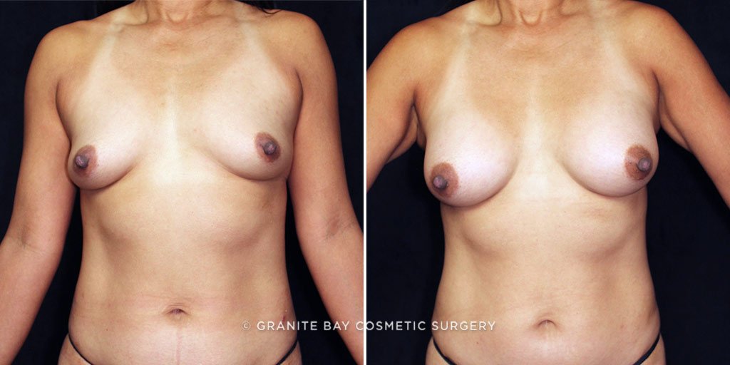 Case # 26 after photo