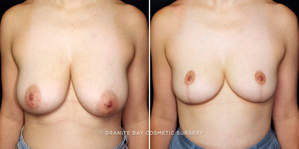 Case # 8 after photo