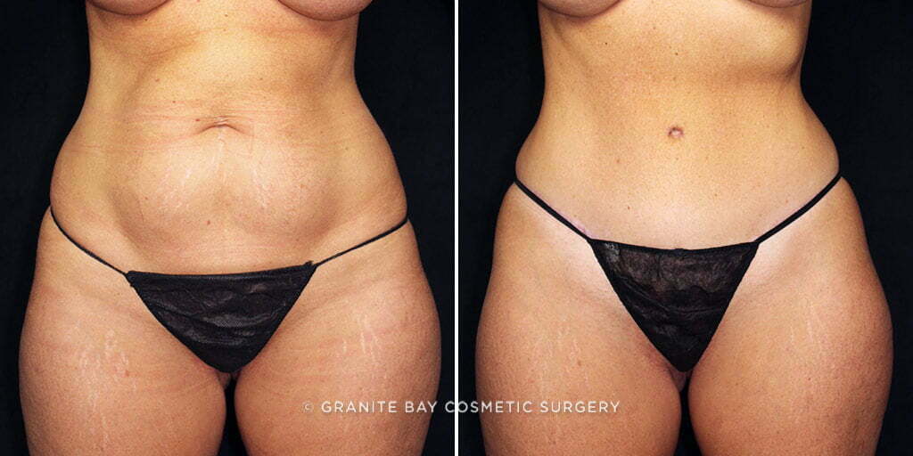 Case # 34 after photo