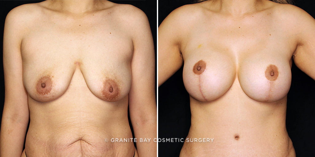 Case # 10 after photo