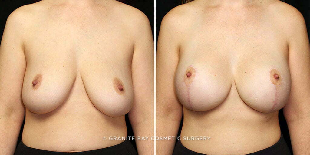 Case # 11 after photo