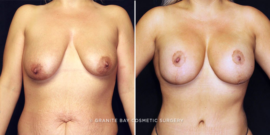 Case # 12 after photo