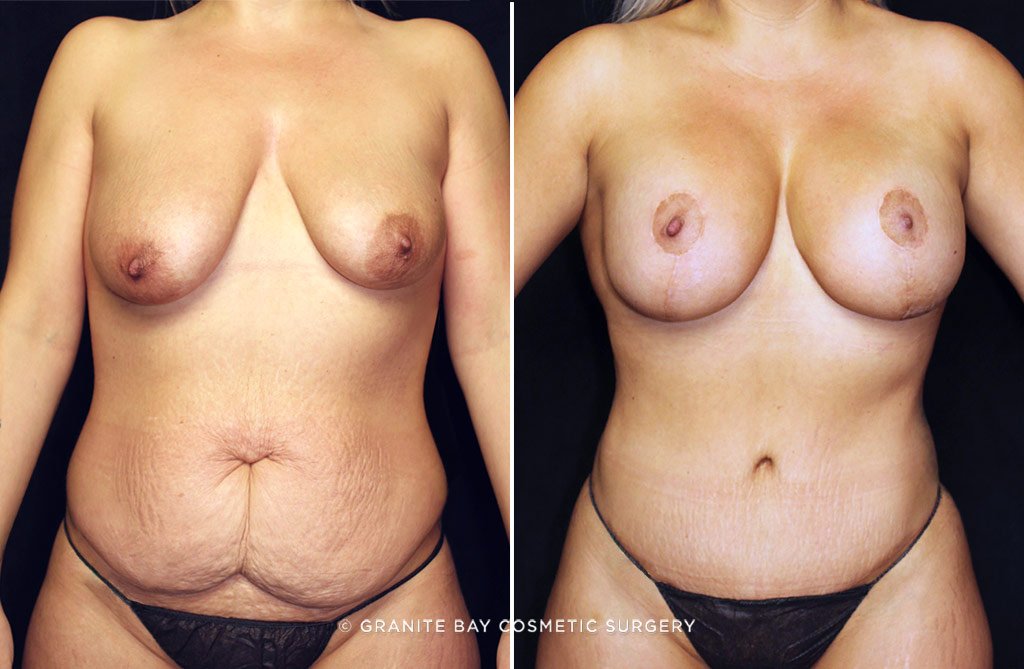 Case # 21 after photo