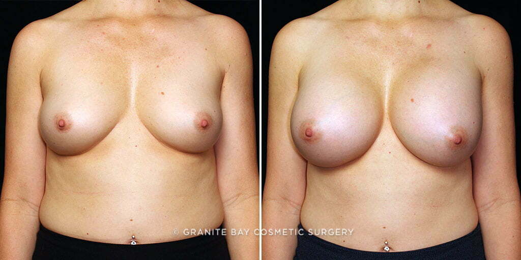 Case # 29 after photo