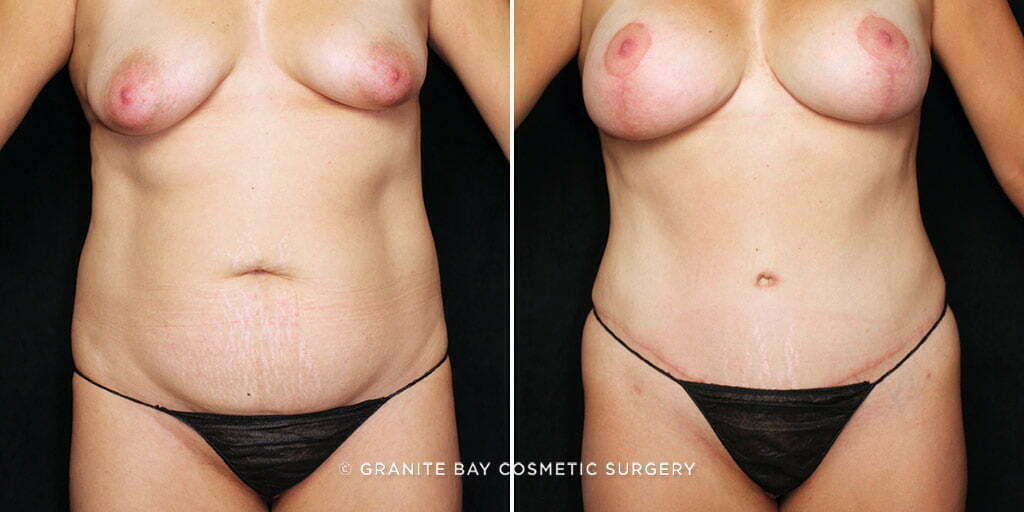 Case # 37 after photo