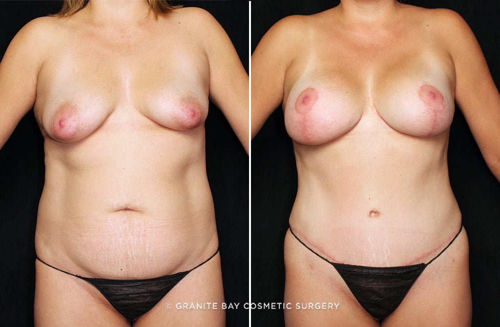 Case # 22 after photo