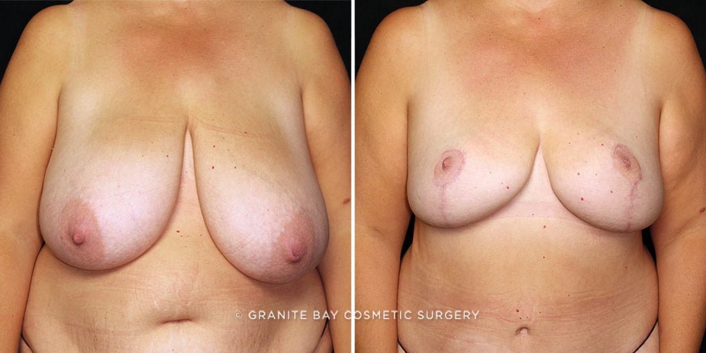 Case # 12 after photo