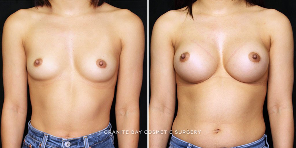 Case # 30 after photo