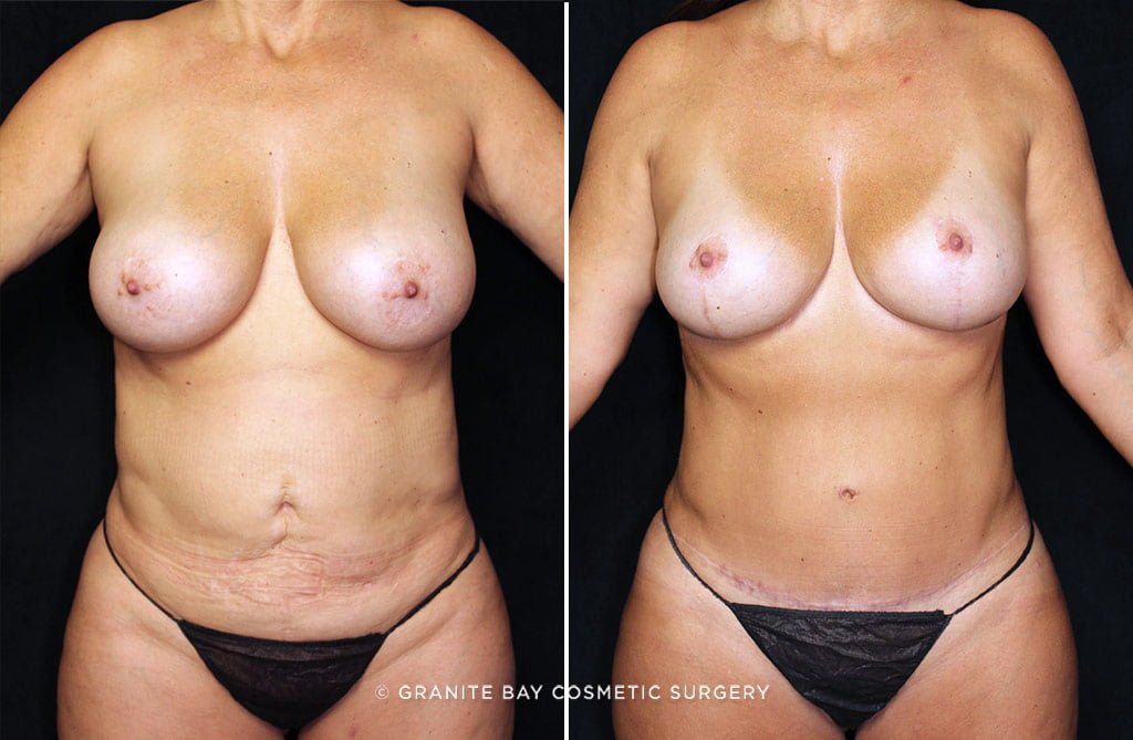 Case # 24 after photo