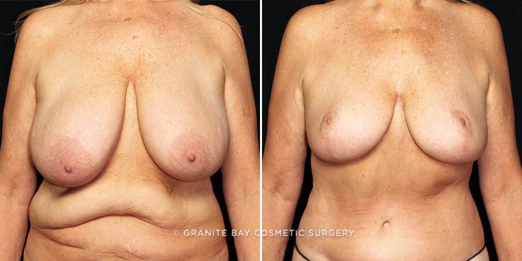 Case # 9 after photo