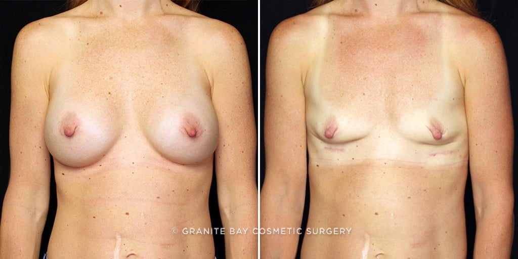 Case # 16 after photo