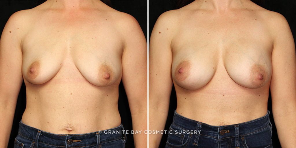 Case # 31 after photo