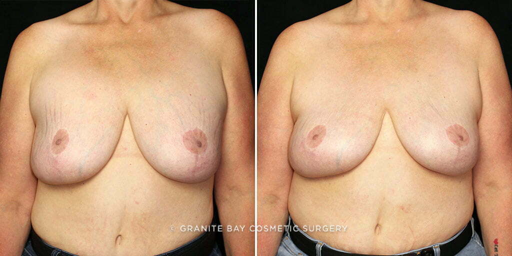 Case # 18 after photo