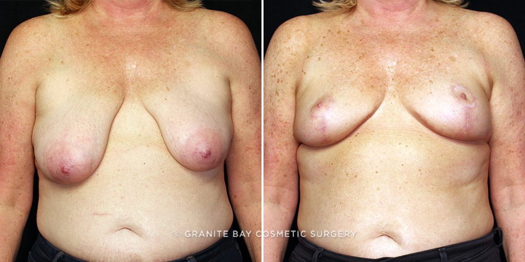 Case # 10 after photo