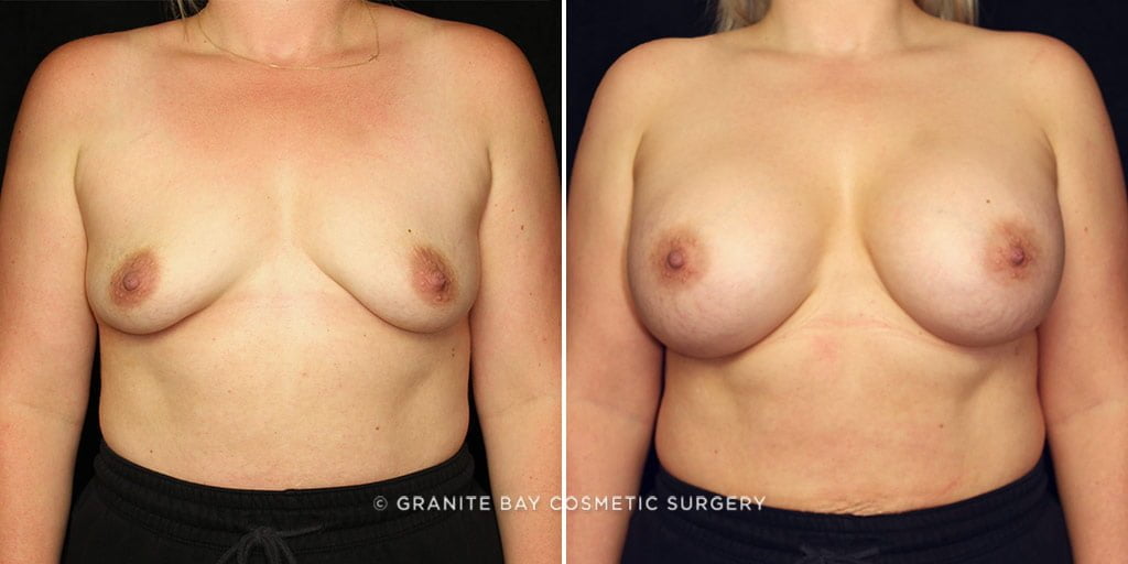 Case # 32 after photo