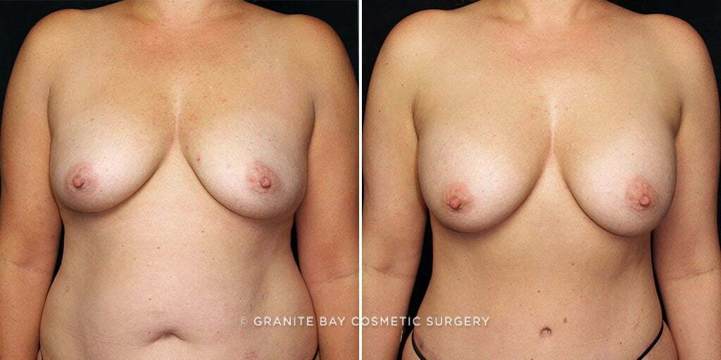 Case # 34 after photo