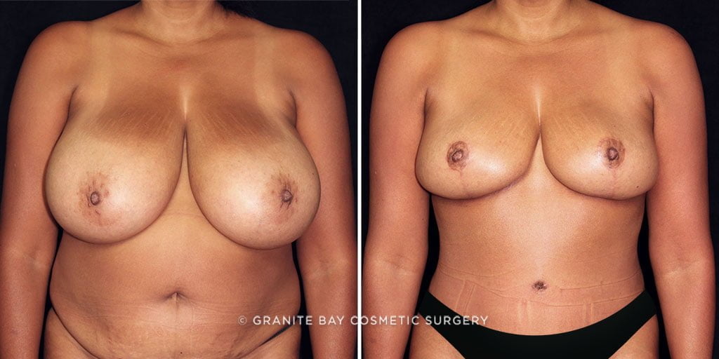 Case # 13 after photo