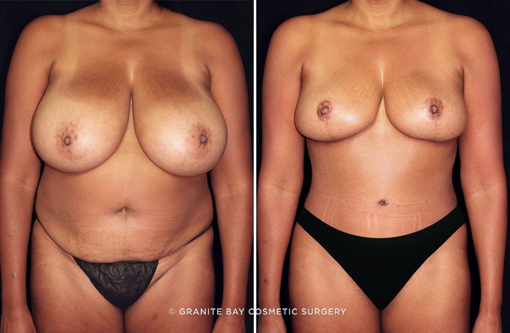 Case # 27 after photo