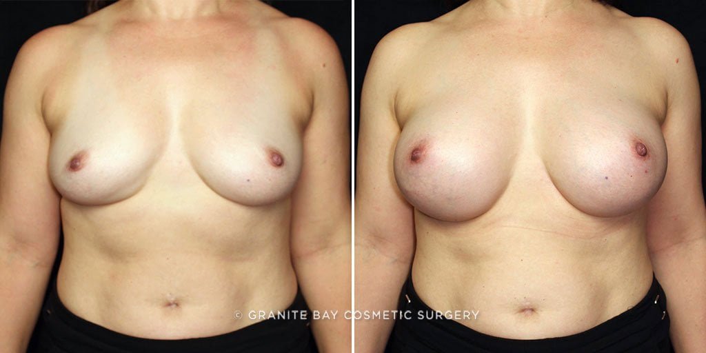 Case # 35 after photo