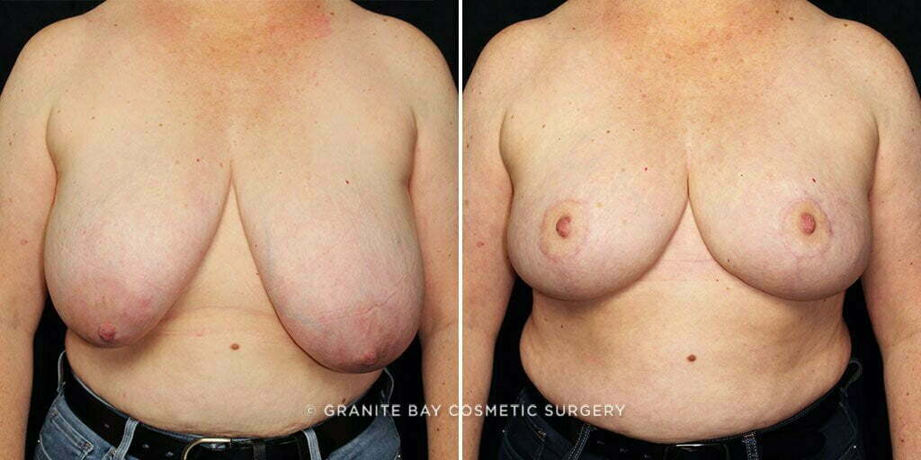 Case # 11 after photo