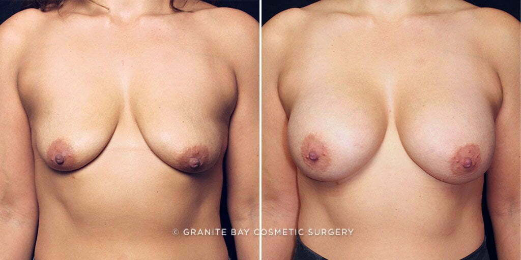 Case # 36 after photo