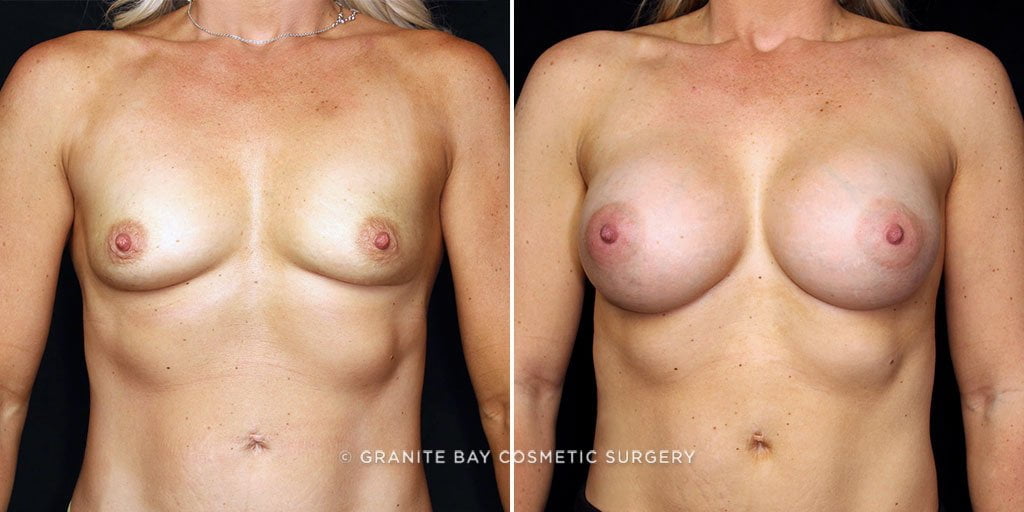 Case # 37 after photo