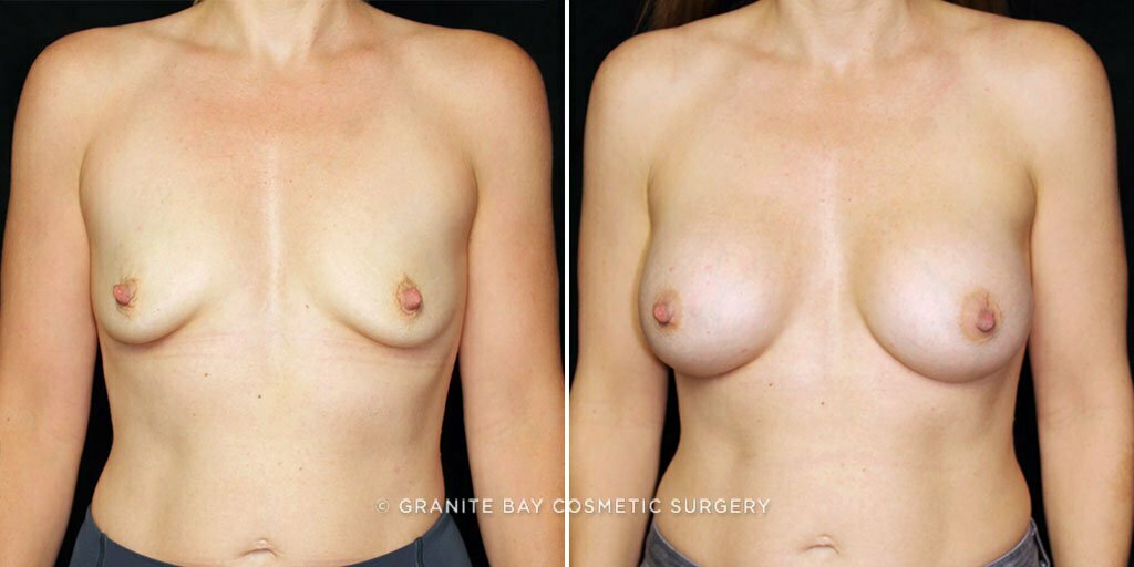 Case # 38 after photo