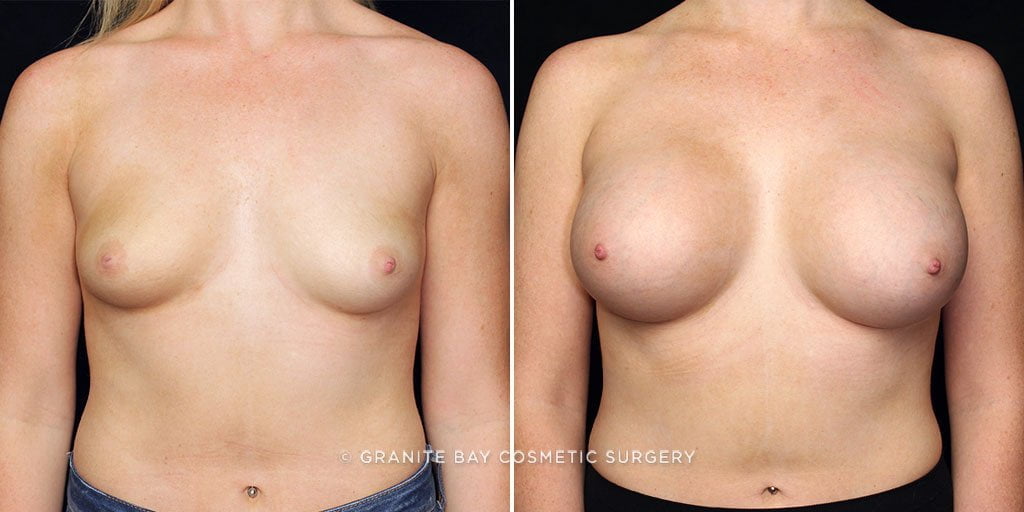 Case # 39 after photo