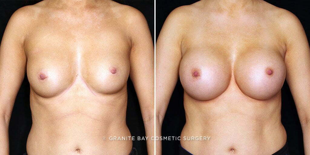 Case # 41 after photo