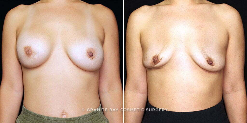 Case # 19 after photo