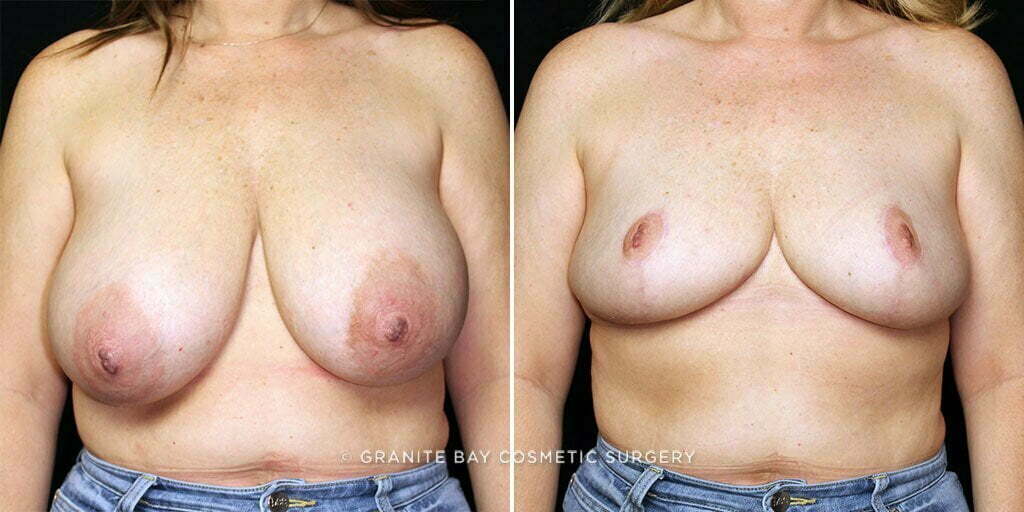 Case # 20 after photo