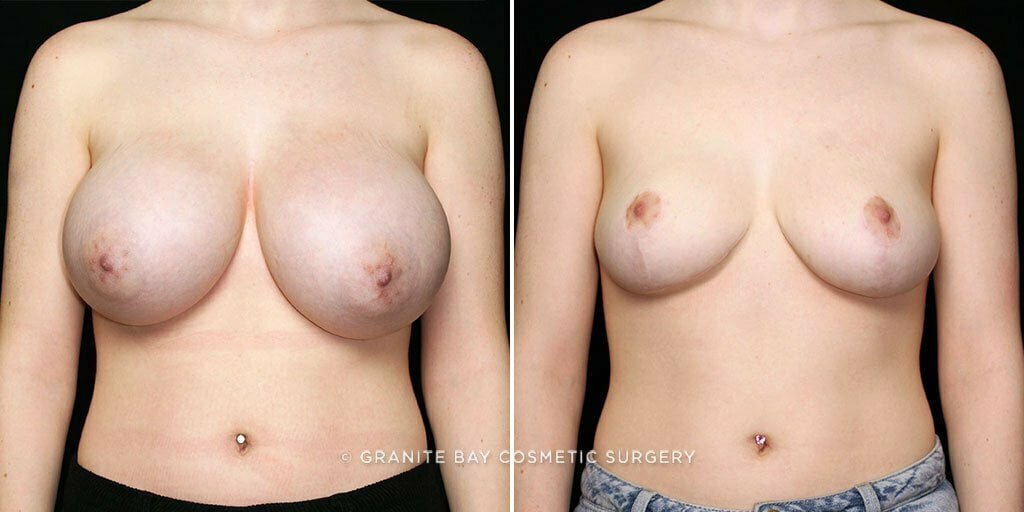 Case # 15 after photo