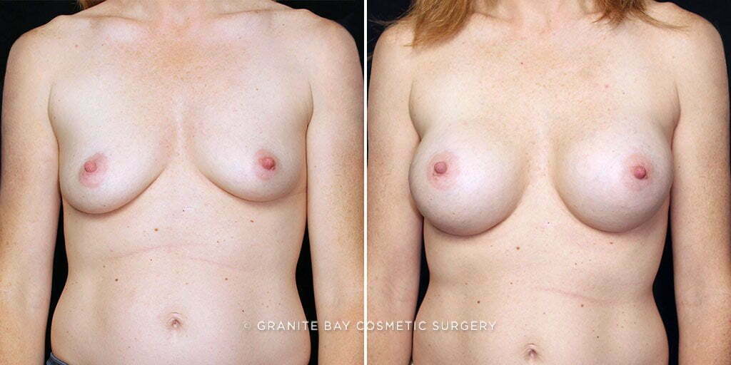 Case # 42 after photo